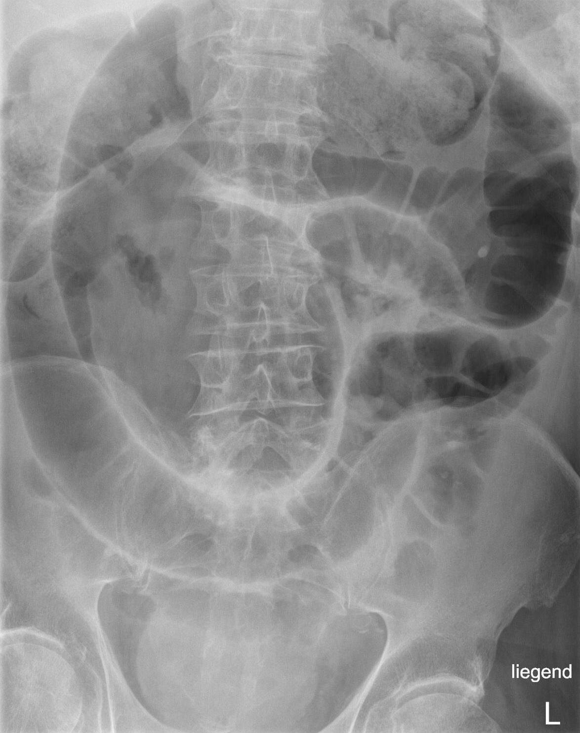 Case 07, image A: frontal abdominal radiograph
