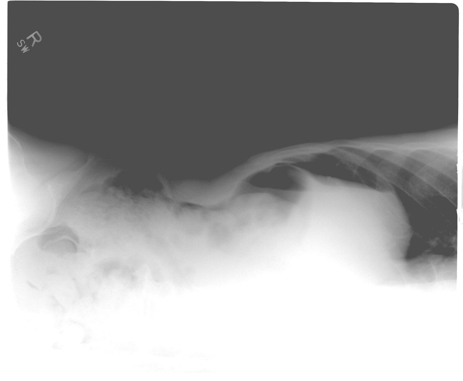 Case 08, image B: left lateral decubitus abdominal radiograph